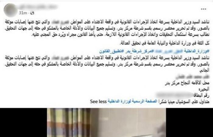 بالبلدي: «معركة
      النسايب»..
      تاجر
      سمك
      يمزق
      جسد
      شقيق
      زوجته
      بسلاح
      أبيض
      في
      البحيرة
