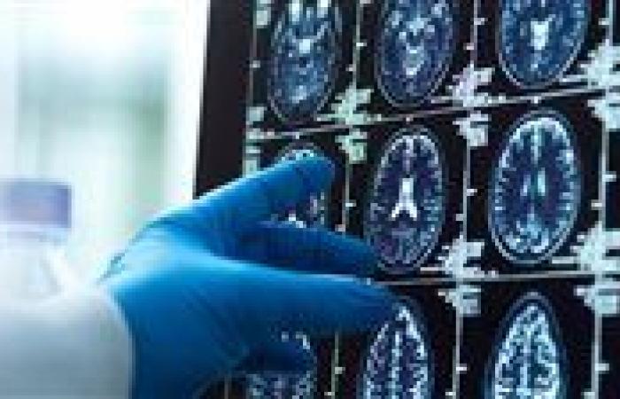 بالبلدي: اضطراب
      الدماغ..
      ما
      هو؟
      وكيف
      تتعامل
      معه؟