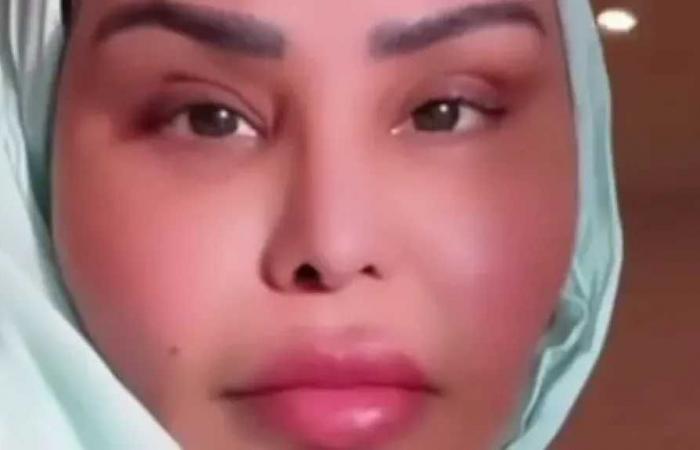 أحلام
      الشامسي
      تتصدر
      تريند
      جوجل
      بعد
      خضوعها
      لإجراء
      تجميلي
      جديد
