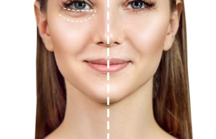 بالبلدي : أشهر عمليات التجميل في العالم