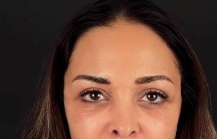 بالبلدي: داليا
      البحيري
      تتصدر
      التريند
      بعد
      نجاح
      عملية
      التجميل..
      كيف
      بدت
      في
      آخر
      ظهور؟