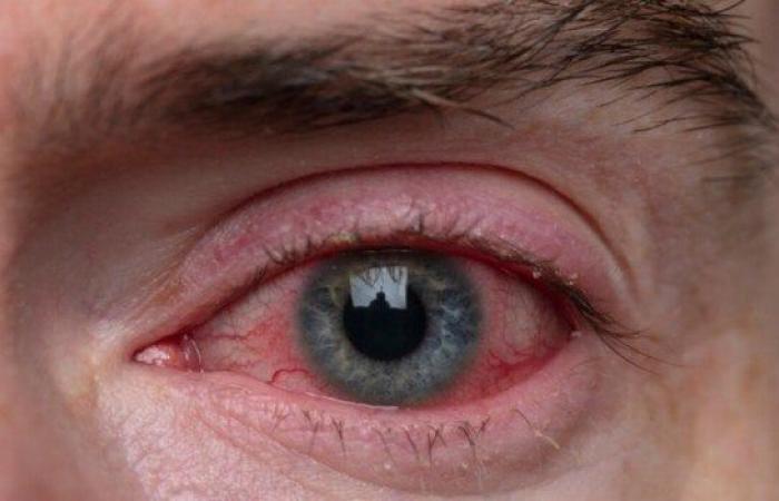 بالبلدي: قبل
      انتشاره..
      اعرف
      التصرف
      الصحيح
      عند
      دخول
      الكلور
      إلى
      العين