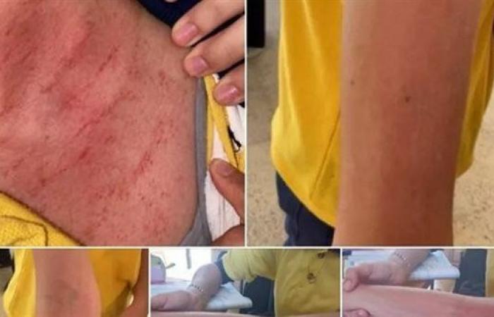 بالبلدي: تعليم
      الجيزة
      تفحص
      واقعة
      ضرب
      طالبتين
      داخل
      مدرسة..
      وتحرك
      لمحاسبة
      المسؤولين