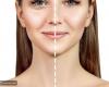 بالبلدي : أشهر عمليات التجميل في العالم