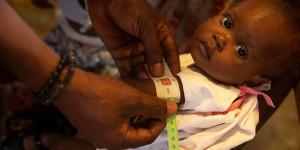بالبلدي : اليونيسيف: الأطفال يواجهون مخاطر صحية كبيرة بسبب الكوليرا في نيجيريا