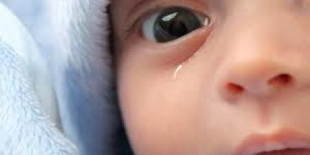 بالبلدي : انسداد القناة الدمعية عند الرضع.. هل تظهر أعراض على الطفل؟