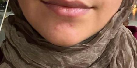 بالبلدي : «لو
      اختفيت
      يبقى
      بسبب
      أهلي»..
      التفاصيل
      الكاملة
      لاستغاثة
      فتاة
      بني
      سويف