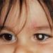 بالبلدي : نظام غذائي جيد لتحسين صحة العين للأطفال.. أخصائي يوضح
