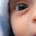 بالبلدي : انسداد القناة الدمعية عند الرضع.. هل تظهر أعراض على الطفل؟