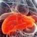 بالبلدي : خبراء يحذرون من ارتفاع معدلات الإصابة بمرض الكبد الدهني في بريطانيا بسبب السمنة والسكري